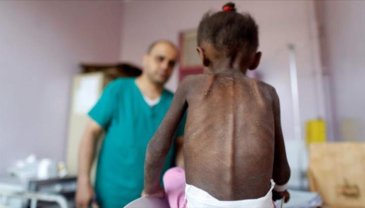 UNICEF: “In Yemen 10,200 children have been killed or injured